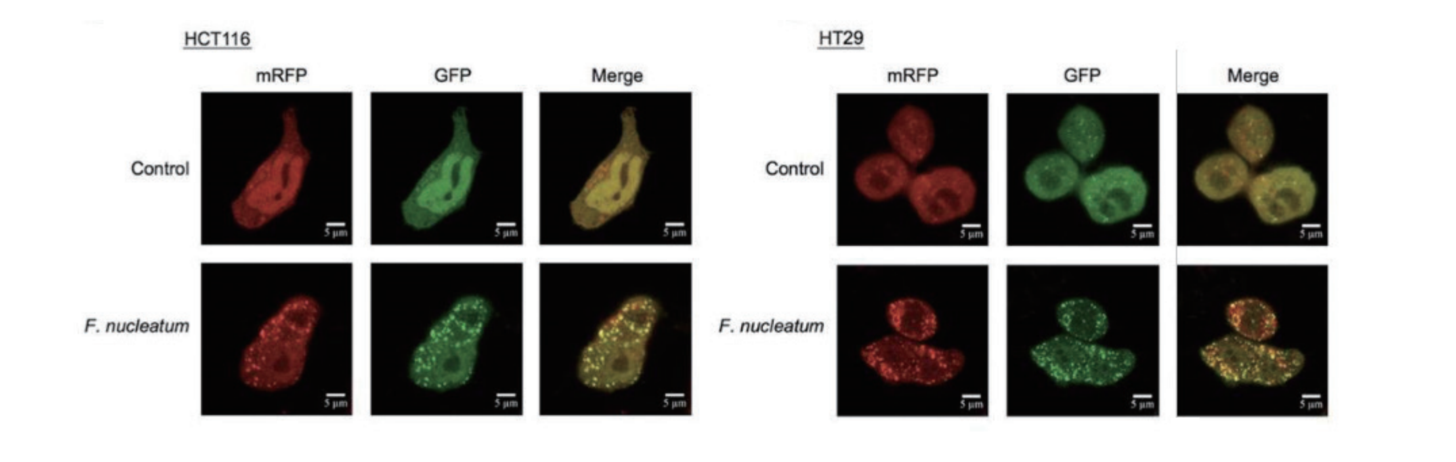 mRFP-GFP-LC3 自噬双标腺病毒