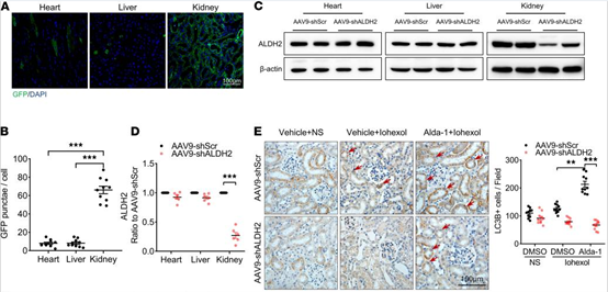AAV9-Kspc-shALDH2特异性感染肾小管上皮