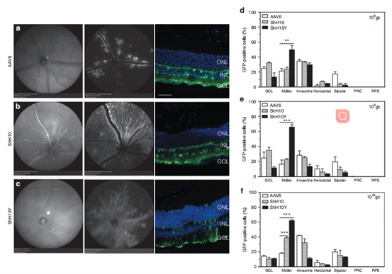 AAV6、AAV-shH10和AAV-shH10Y感染穆勒细胞结果图