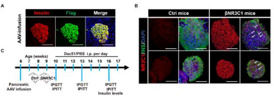 AAV-Ins2-Nr3c1特异性感染胰腺β细胞