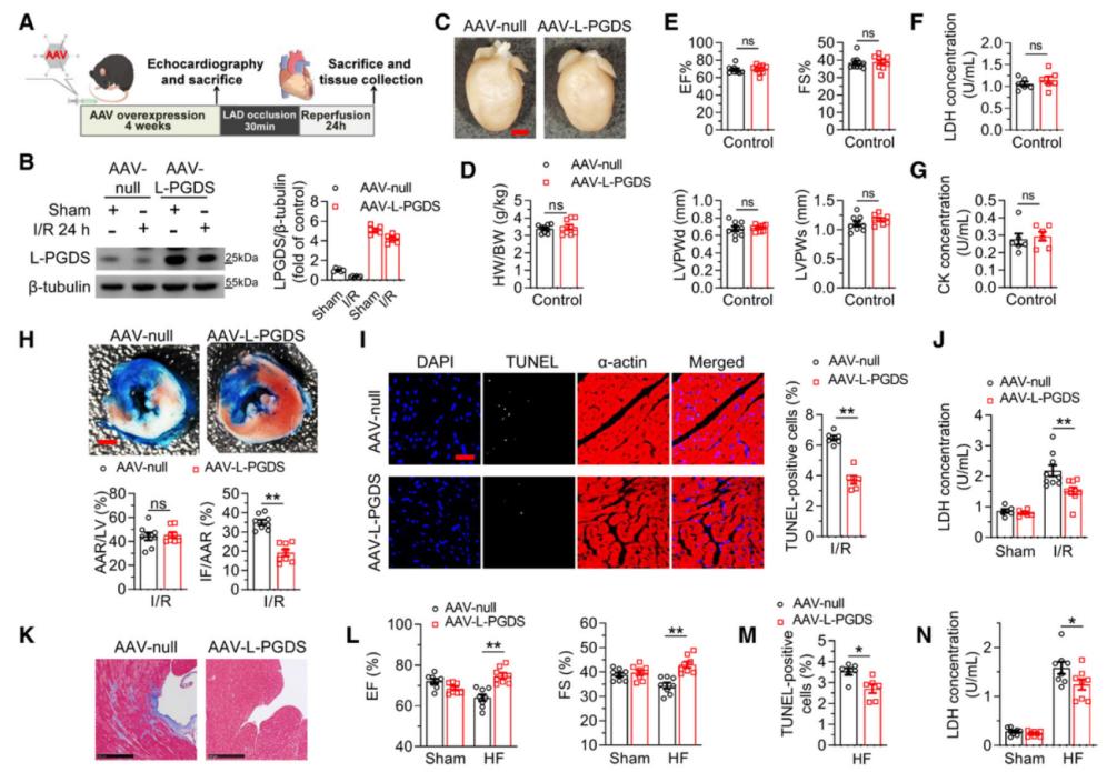 L-PGDS上调减轻I/R导致的心肌损伤、心脏重构及心衰