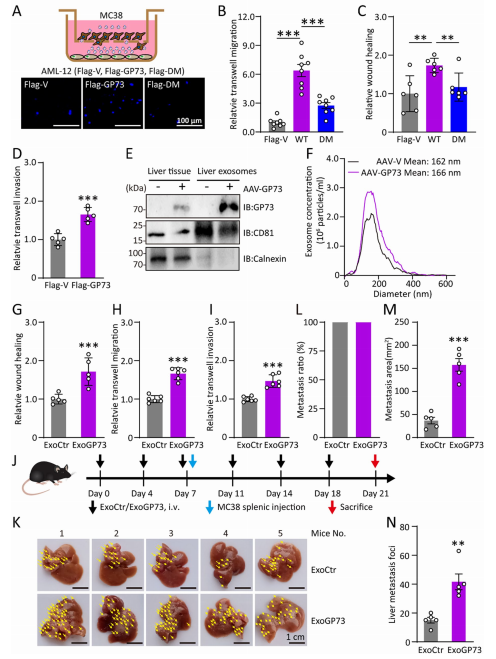 源自高GP73肝细胞的外泌体具有促转移作用