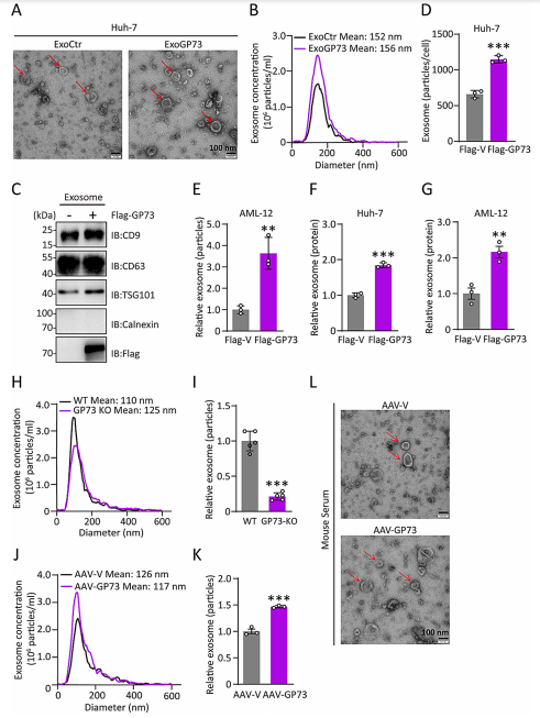 GP73促进外泌体的产生