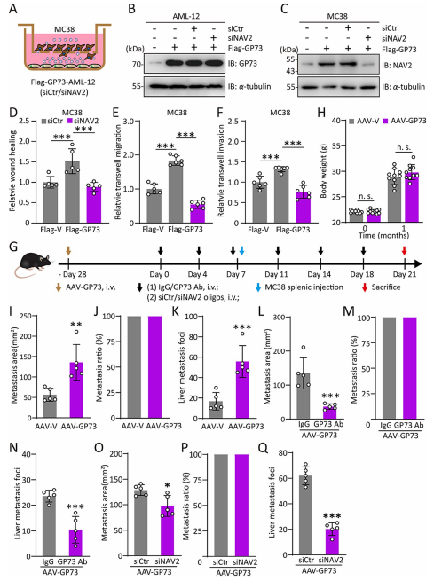 沉默NAV2可抑制GP73诱导的CRC肝转移