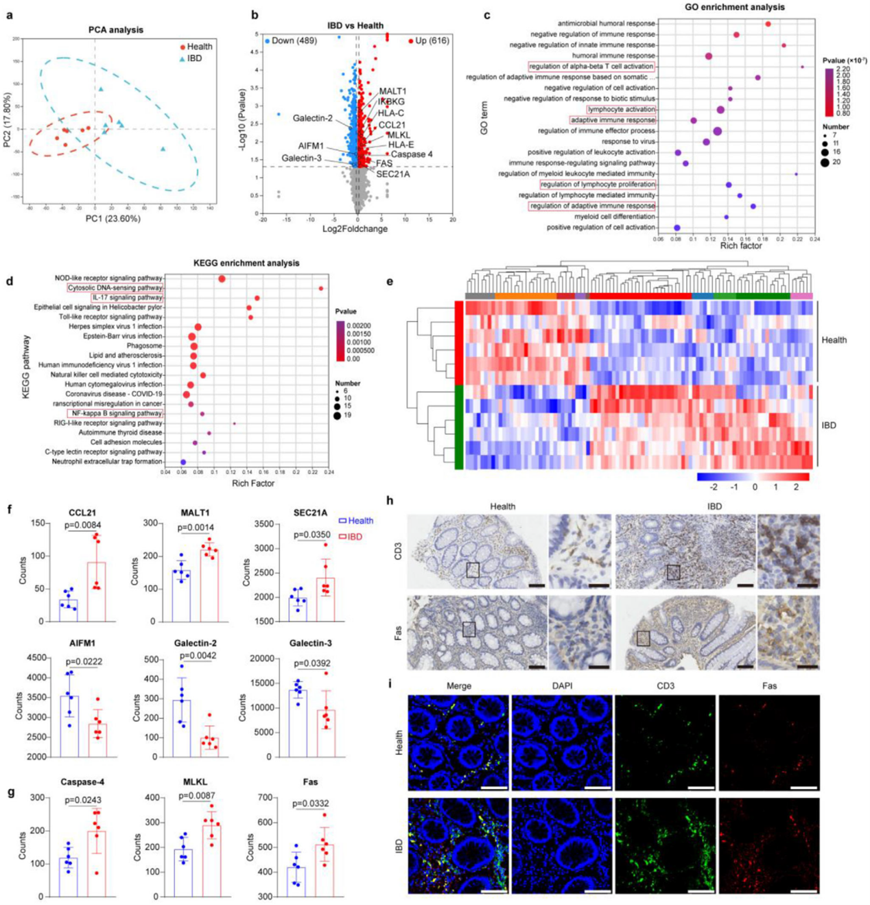 UC患者结肠的蛋白质组学研究及Fas表达水平分析