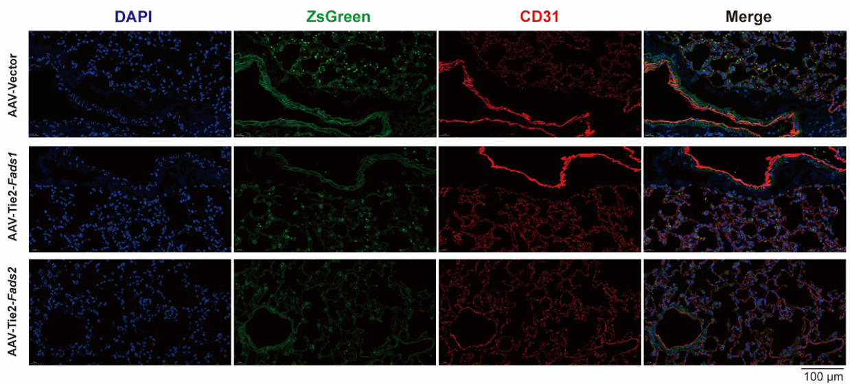 AAV-VEC-TIE2通过气管内注射感染小鼠肺血管内皮