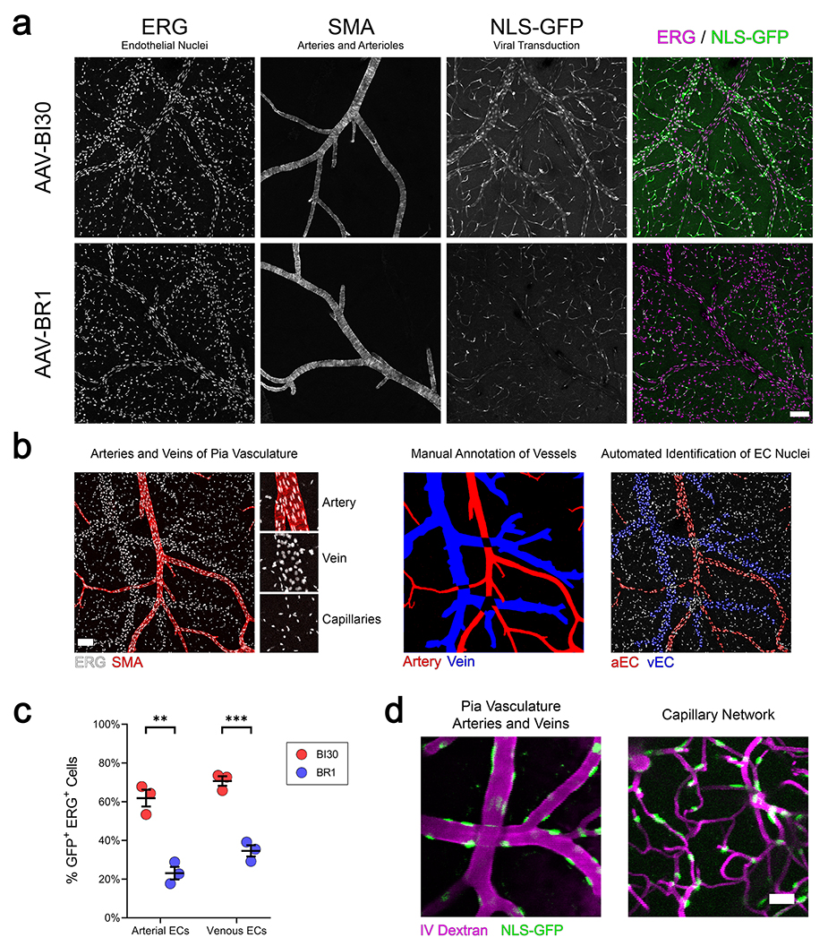 左:AAV-BR1经尾静脉注射靶向感染大脑;右:AAV-BRA1感染脑内皮细胞
