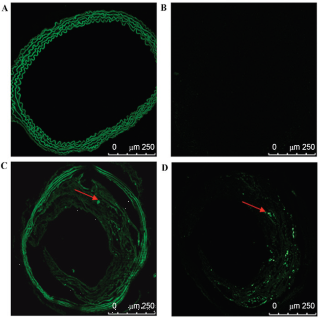 AAV9感染小鼠颈动脉