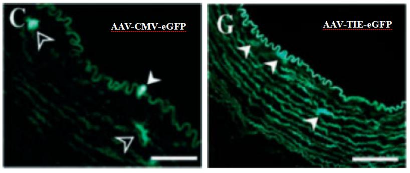 AAV-TIE1-eGFP高效感染血管内皮细胞