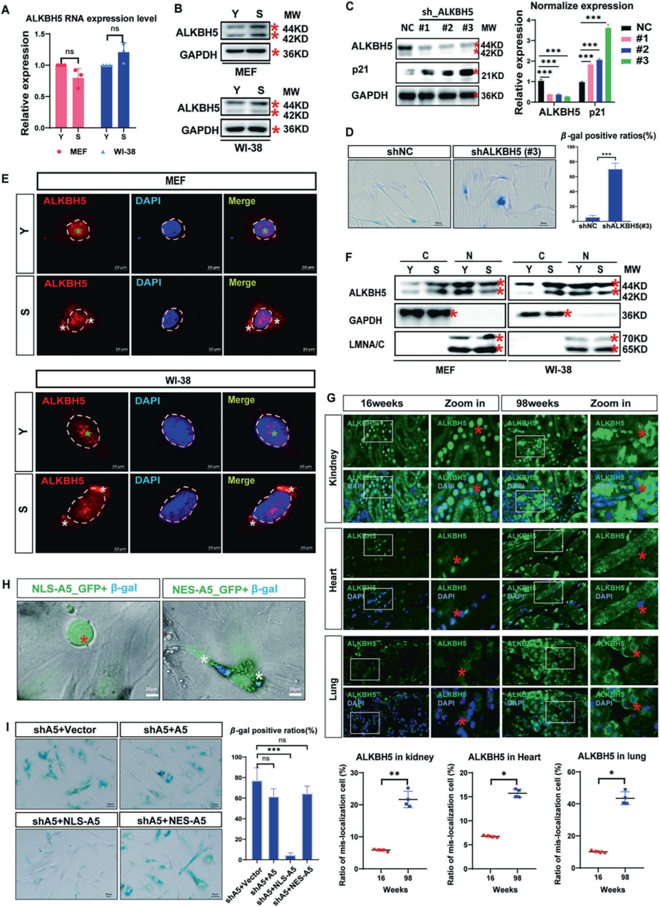 ALKBH5胞质滞留促进细胞衰老