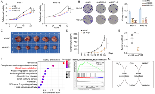 ARD1通过调节GSH代谢来促进肝癌细胞的增殖