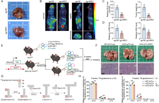 ARD1在体内可促进肝癌的发展,并且是改善索拉非尼疗效的治疗靶点