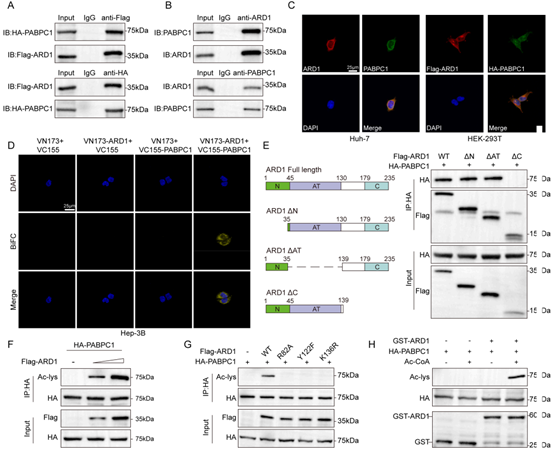 ARD1在PABPC1的K167 位点对其进行乙酰化修饰,促进细胞质定位