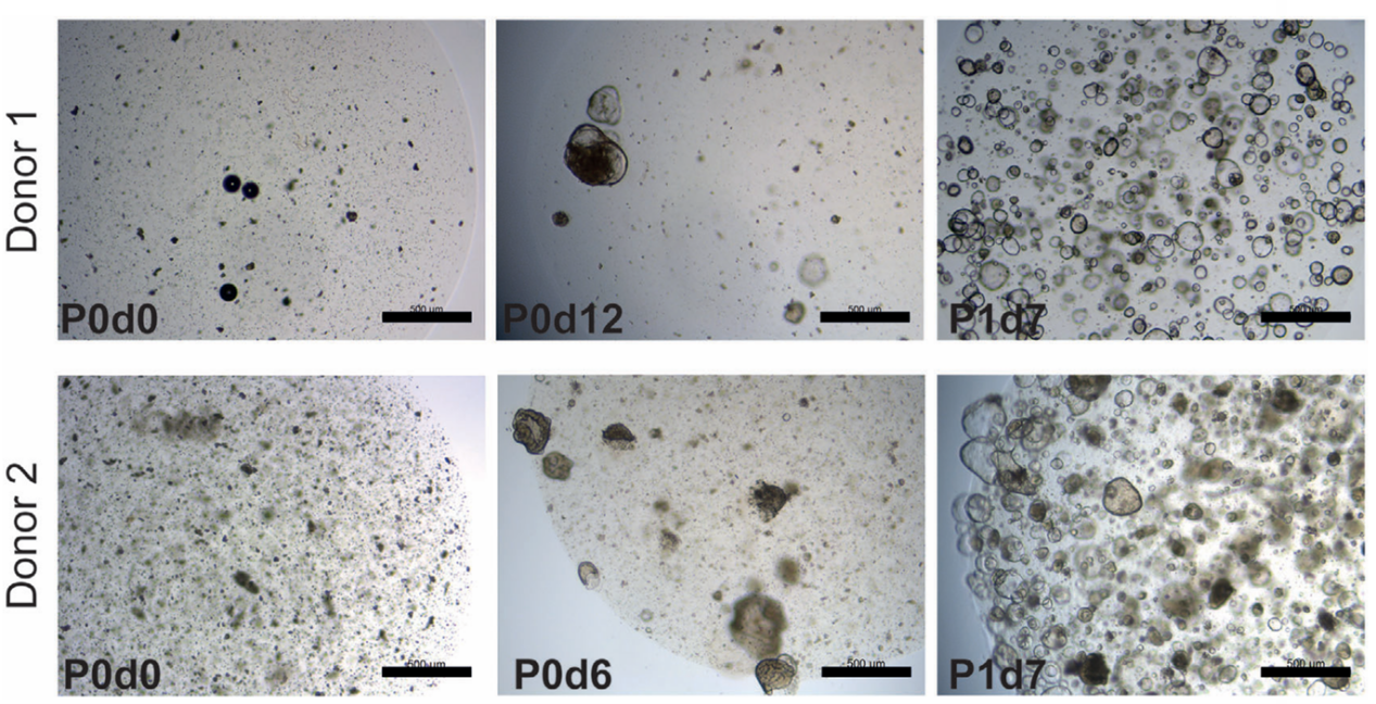 不同阶段肠道类器官培养物形态