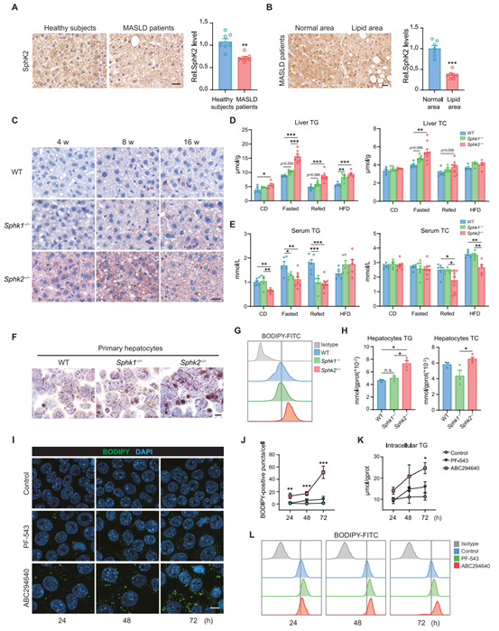 Sphk2−/−小鼠肝脏中TG积聚