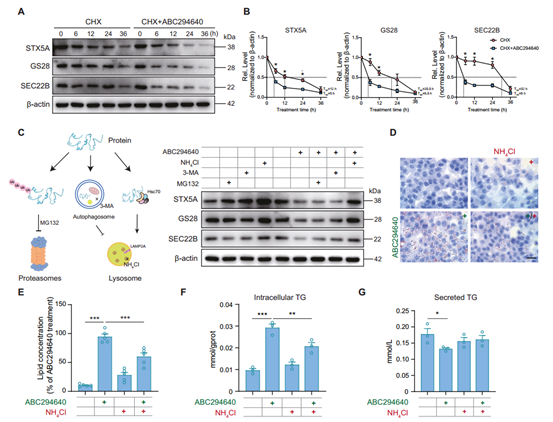 SphK2通过溶酶体相关途径调节SNARE稳定性并加速其降解
