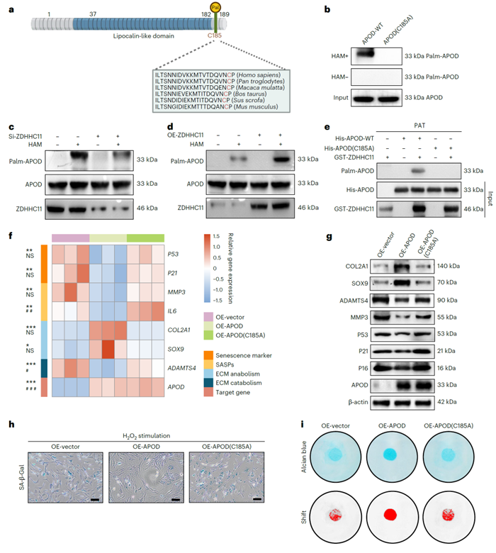 APOD蛋白在C185位点的棕榈酰化修饰可抑制ECM降解代谢及软骨细胞衰老
