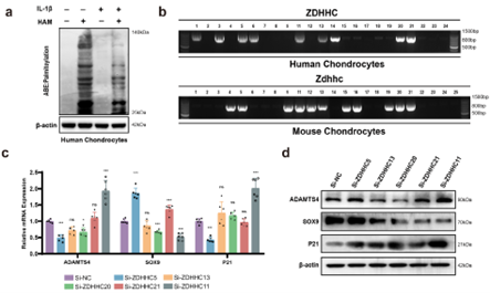 HCs中ZDHHC11的鉴定与表征