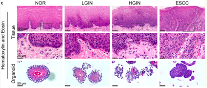  H&E染色观察人食管及ESCC类器官形态