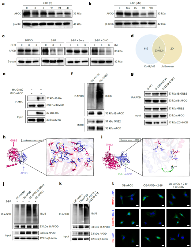 APOD去棕榈酰化通过E3泛素连接酶GNB2介导蛋白酶体途径降解