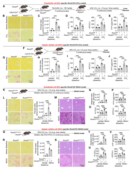 内皮细胞和肝星状细胞中敲除特异性ROCK2的基因可减轻小鼠模型肝纤维化和损伤