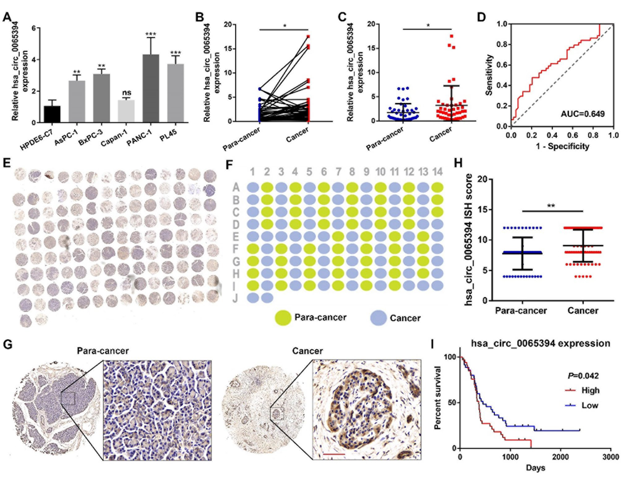 hsa_circ_0065394在PC中的表达及临床特征