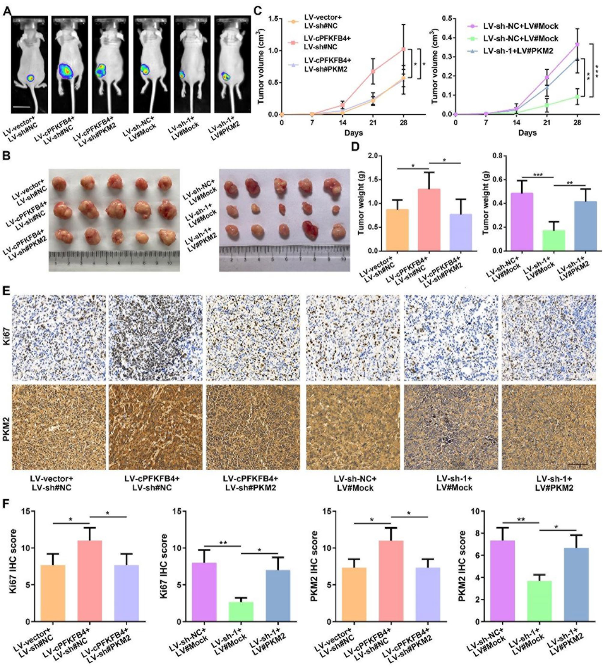 cPFKFB4通过PKM2在体内促进PC生长