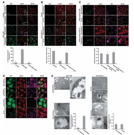 LC3与GABARAP在自噬体生物发生中具有差异化功能