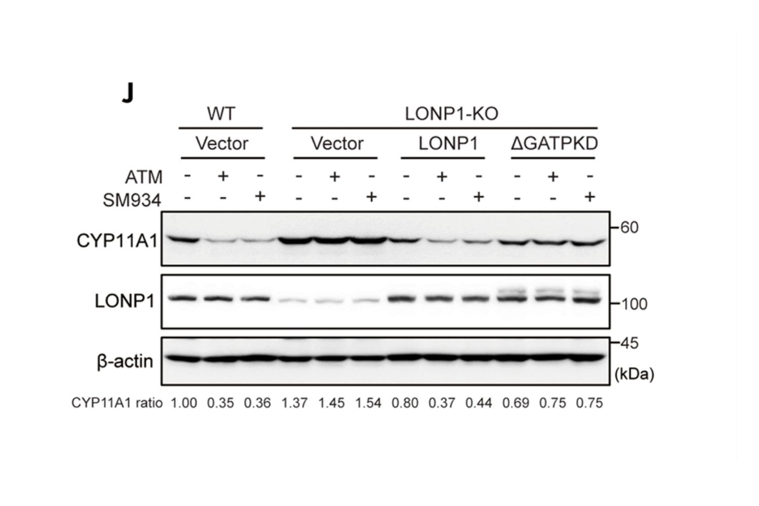 文章 Fig. 6J：LONP1 敲除与回补实验证明青蒿素下调 CYP11A1 依赖于 LONP1